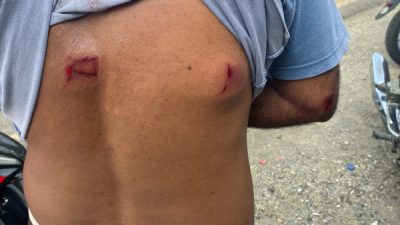 Salah satu warga yang terkena tembakan